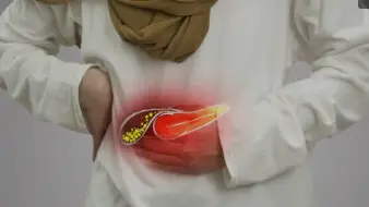 पित्त की पत्थरी – लक्षण , कारण , उपचार(Gall Bladder Stone: Symptoms, Causes, and Treatments in Hindi)