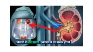 Detox Kidneys